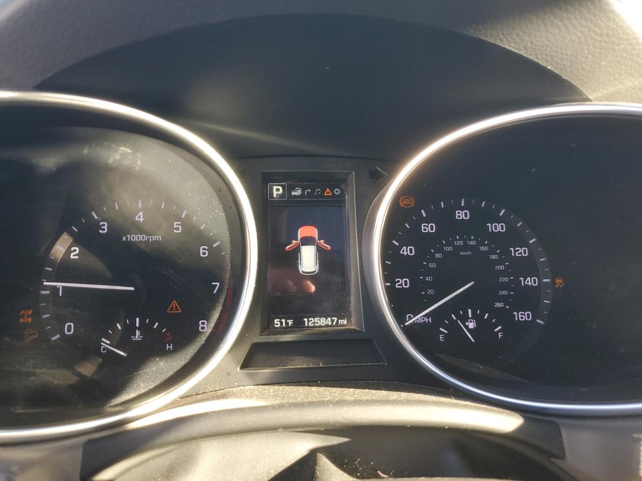 2017 Hyundai Santa Fe Se Ultimate VIN: KM8SRDHF2HU167118 Lot: 86066325