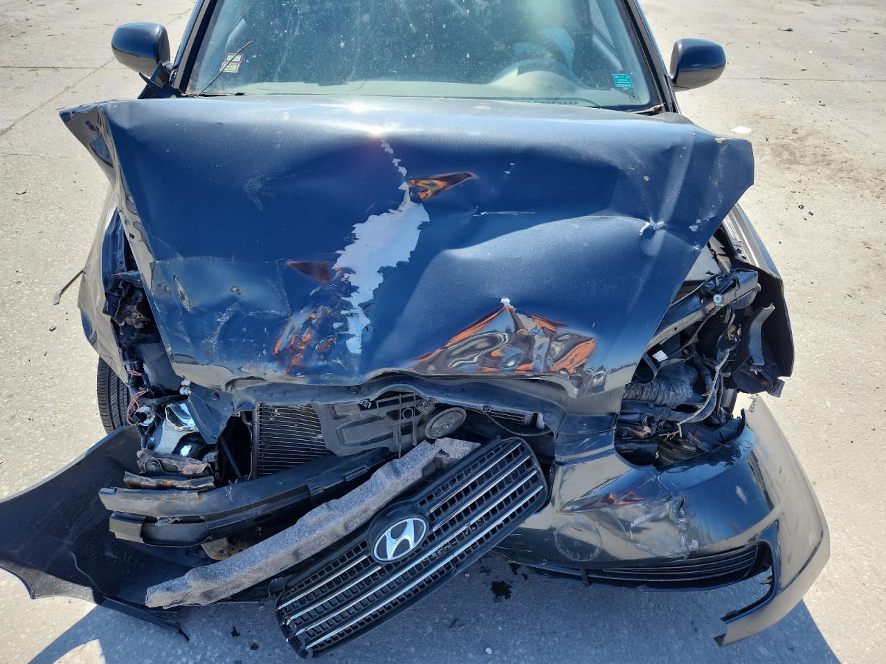 2010 Hyundai Accent Gls VIN: KMHCN4AC8AU472290 Lot: 85366745