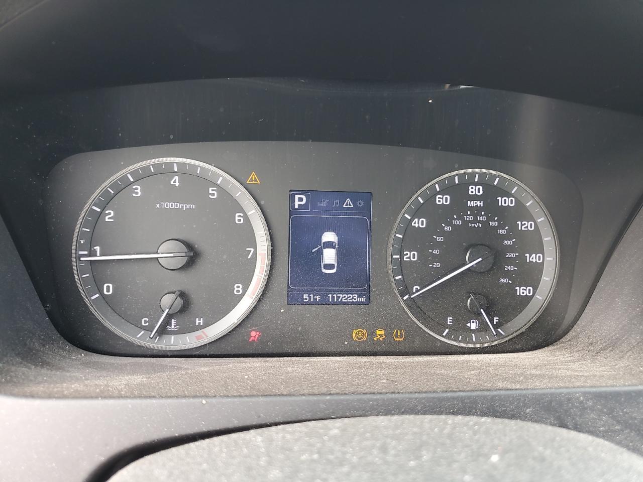 2017 Hyundai Sonata Se VIN: 5NPE24AF0HH556155 Lot: 82775995