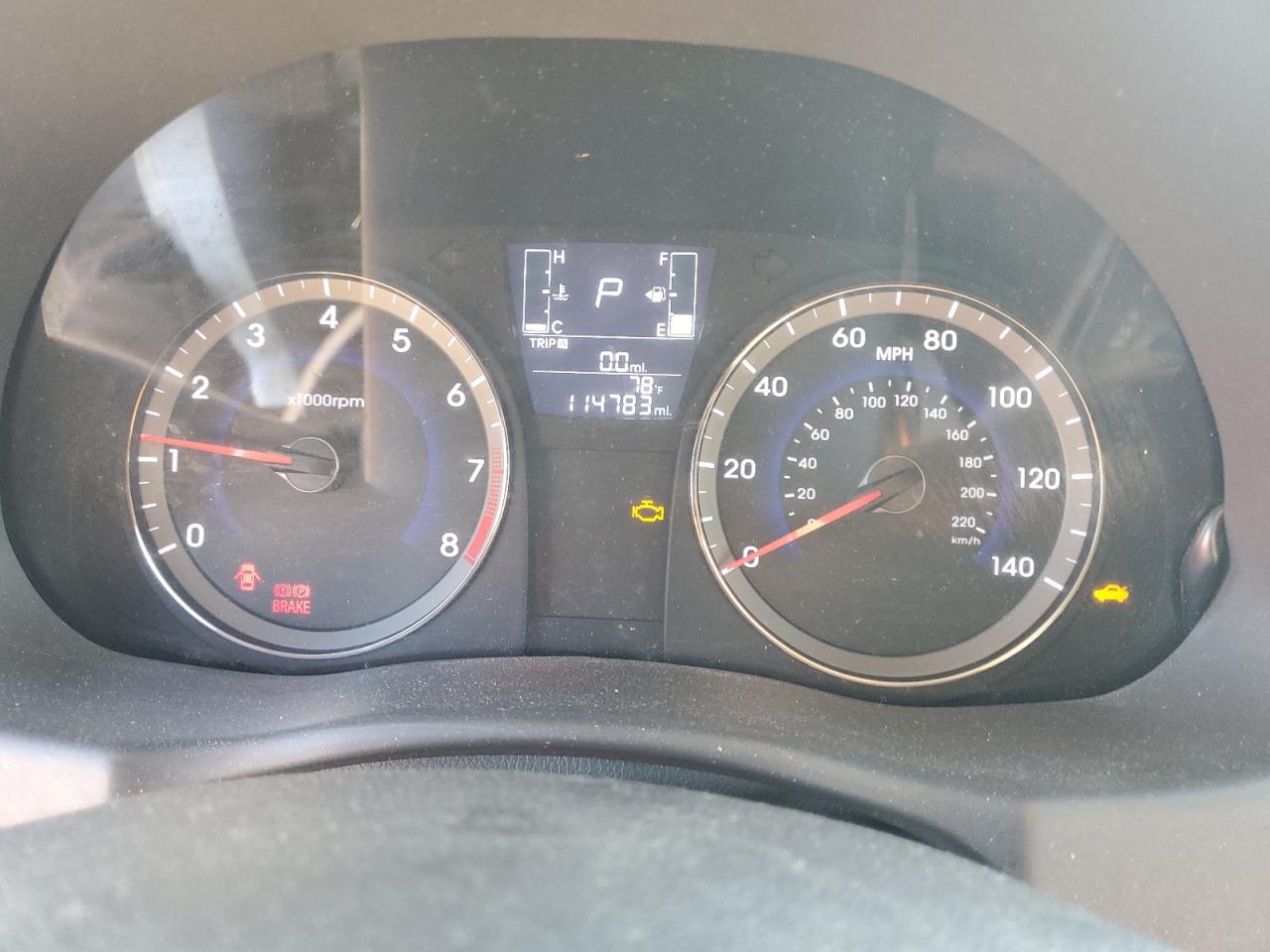 2017 Hyundai Accent Se VIN: KMHCT4AE3HU170391 Lot: 82600265