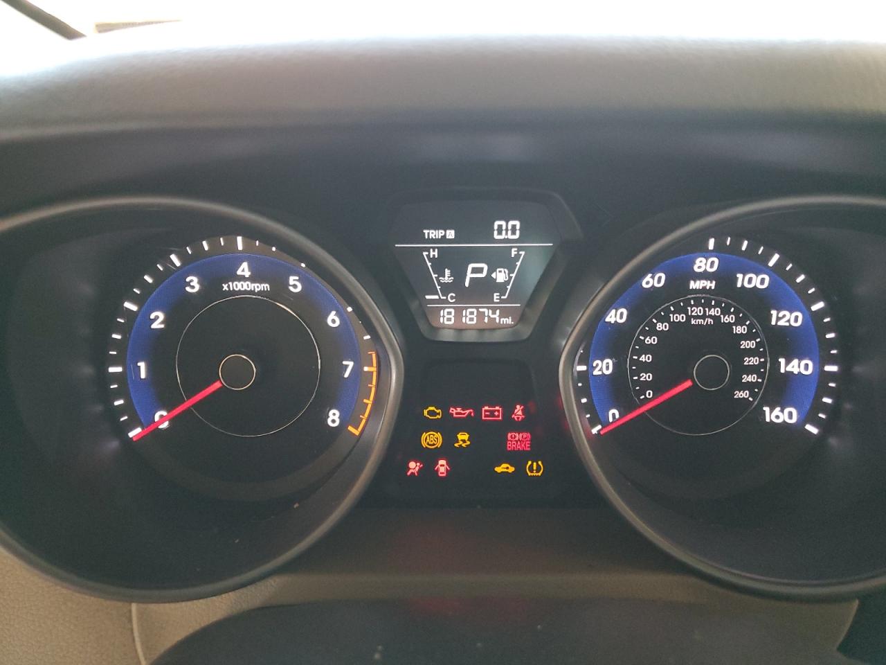 2014 Hyundai Elantra Se VIN: 5NPDH4AE2EH464574 Lot: 81953285