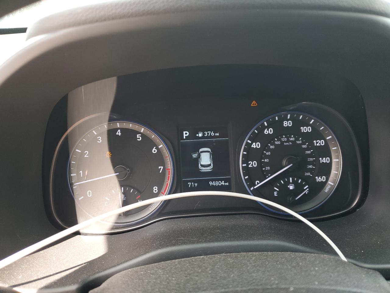 2018 Hyundai Kona Se VIN: KM8K12AA4JU172157 Lot: 85552005