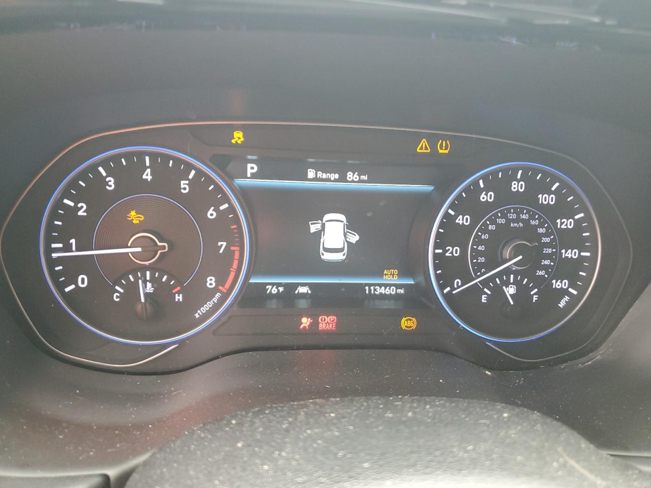 2020 Hyundai Palisade Sel VIN: KM8R44HE5LU145207 Lot: 86153975