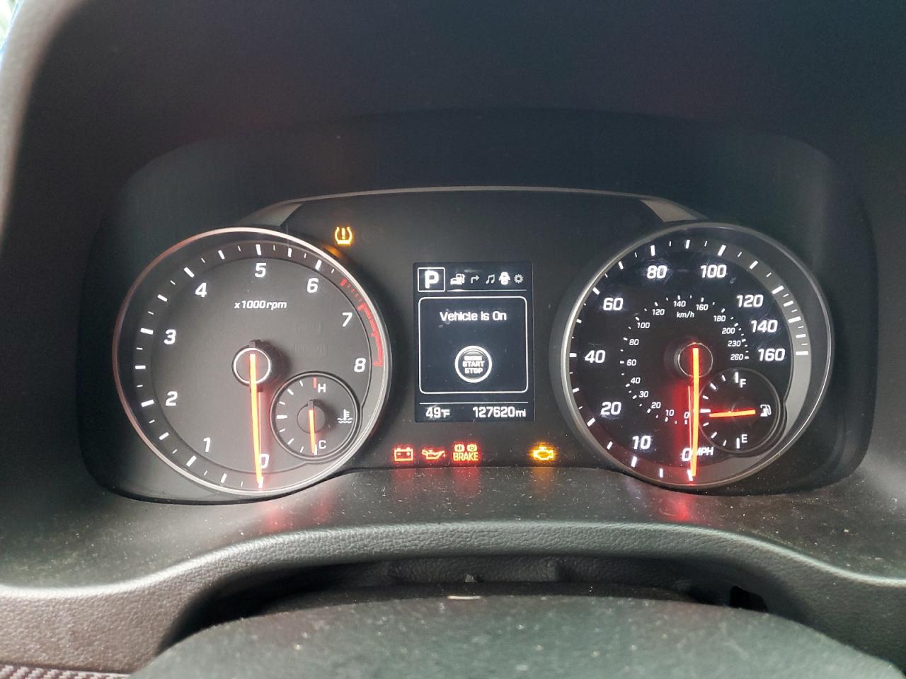 2017 Hyundai Elantra Sport VIN: KMHD04LB2HU319616 Lot: 86667055