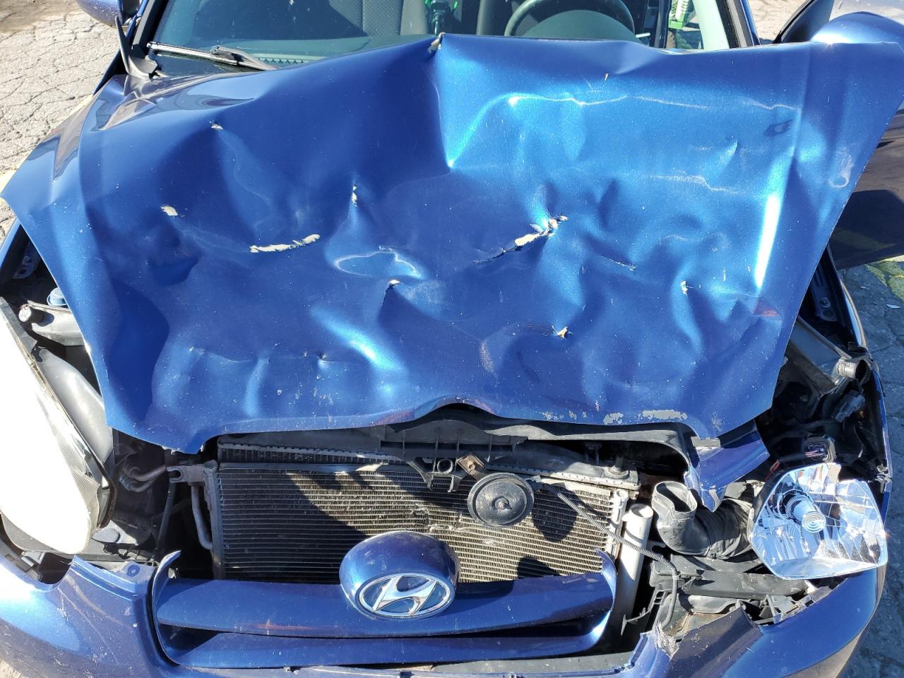 2010 Hyundai Accent Blue VIN: KMHCM3AC0AU169338 Lot: 85682435