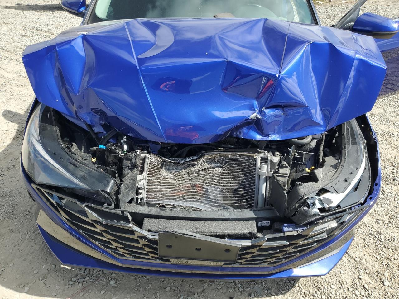 2022 Hyundai Elantra Limited VIN: KMHLN4AJ1NU018824 Lot: 85382655