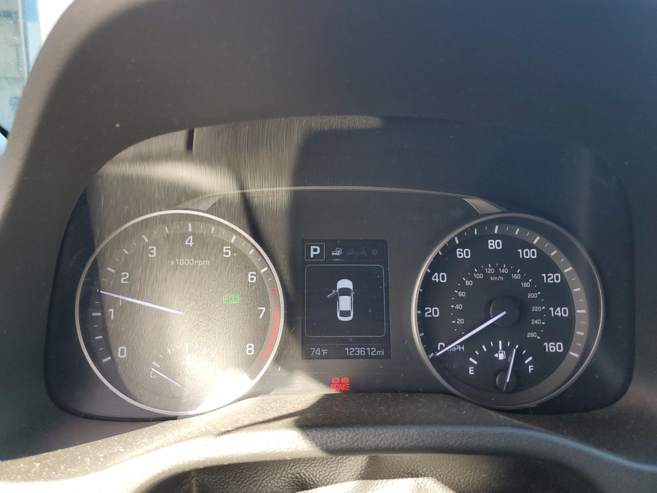 2018 Hyundai Elantra Sel VIN: 5NPD84LFXJH302952 Lot: 82061195