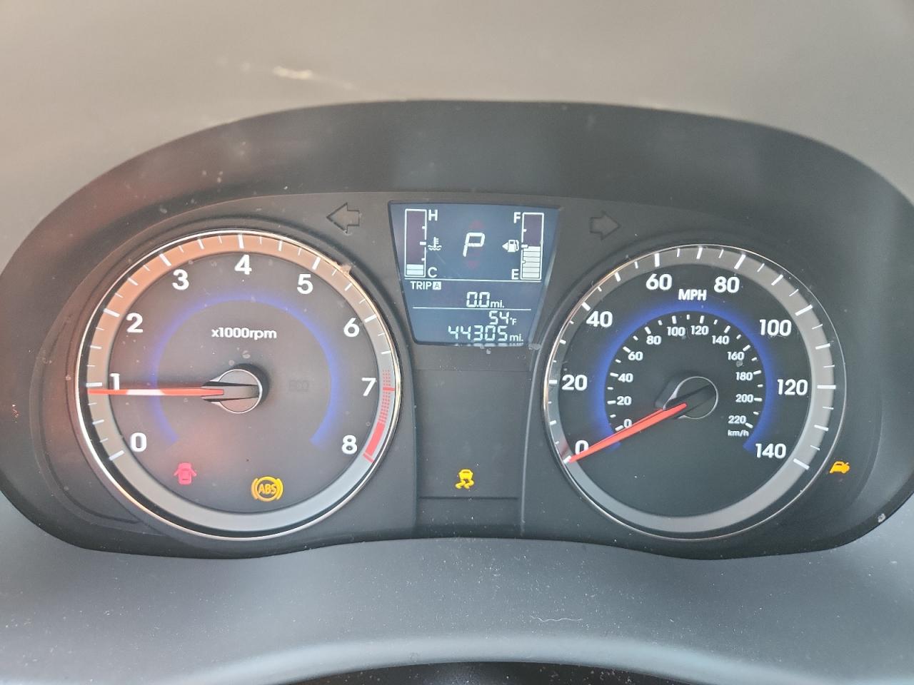 2017 Hyundai Accent Se VIN: KMHCT4AE6HU281453 Lot: 84796715