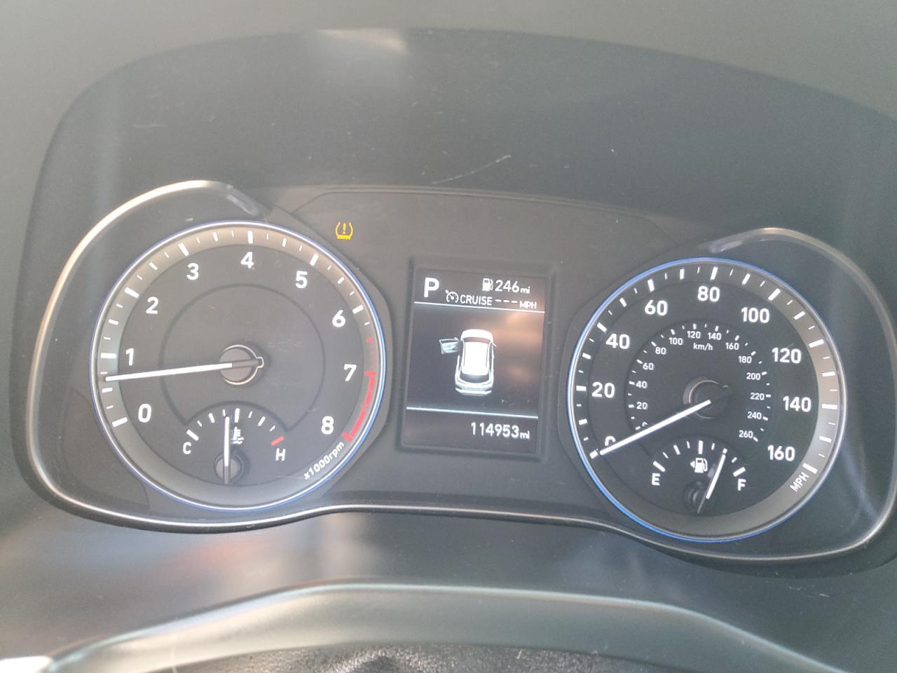 2020 Hyundai Kona Se VIN: KM8K12AA5LU443665 Lot: 89553905