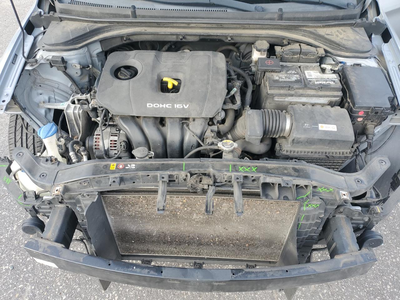 2017 Hyundai Elantra Se VIN: 5NPD74LF1HH151223 Lot: 82424625