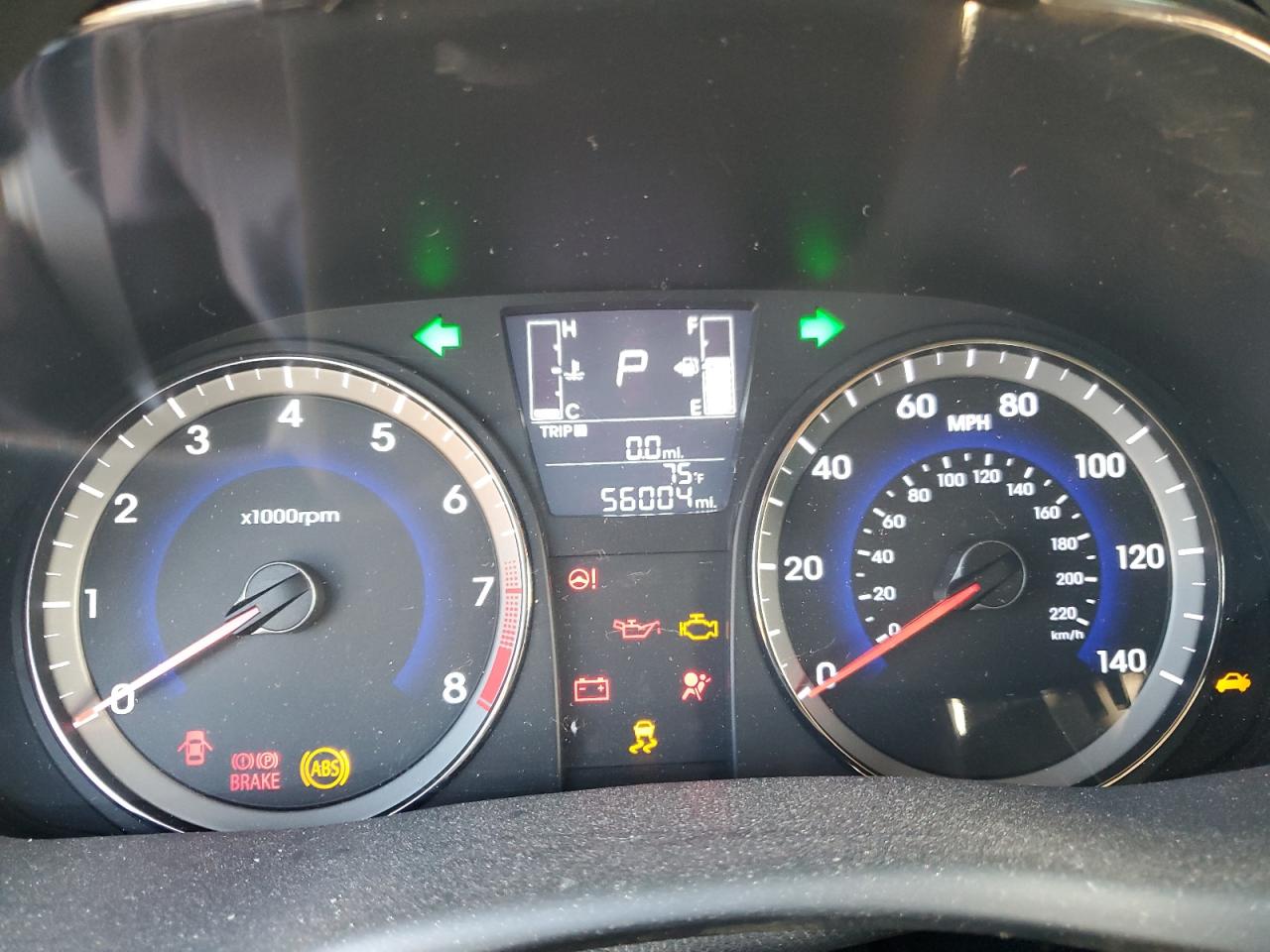 2017 Hyundai Accent Se VIN: KMHCT4AE7HU263057 Lot: 82180555