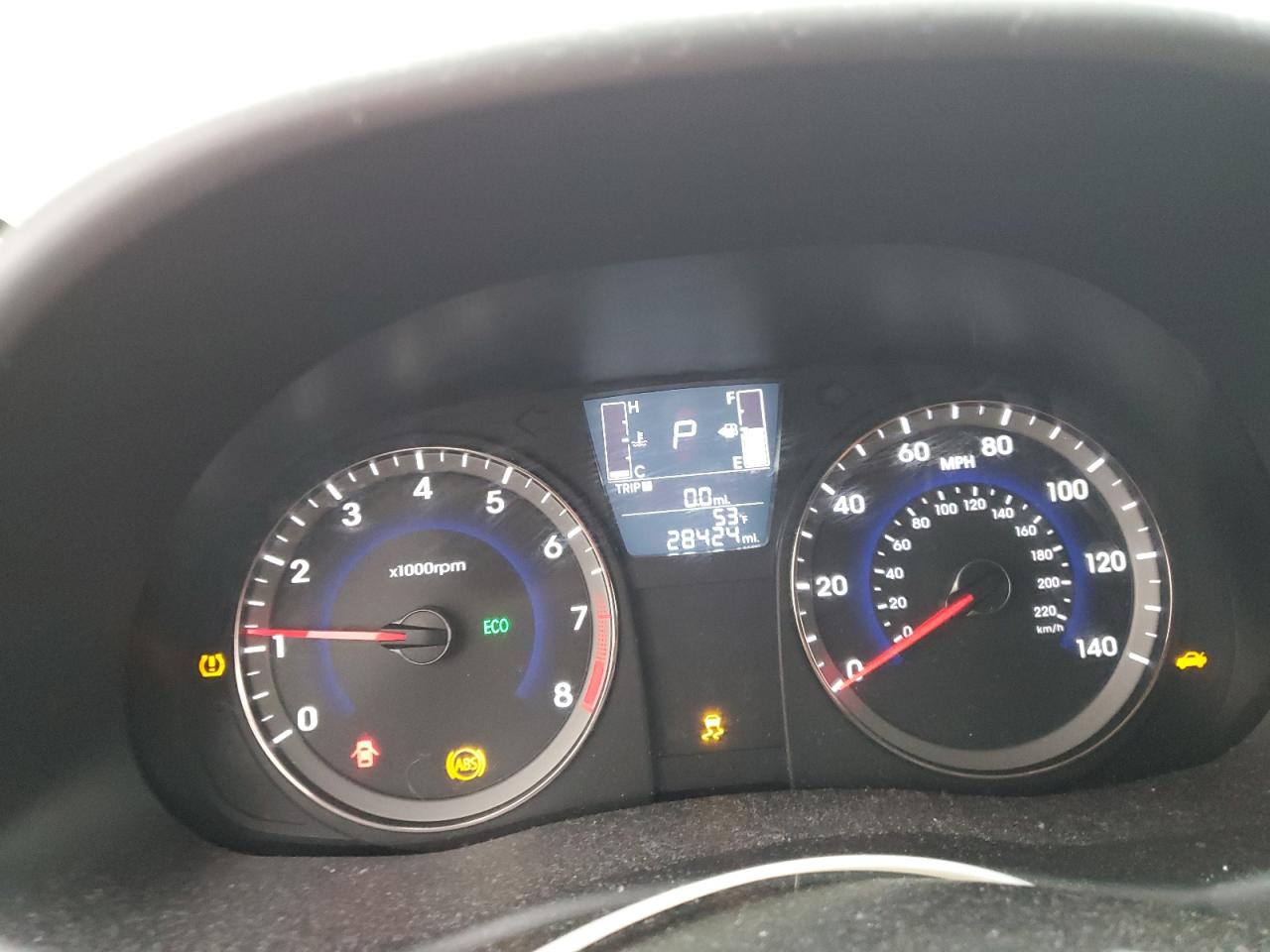 2016 Hyundai Accent Se VIN: KMHCT4AE6GU135147 Lot: 87123635