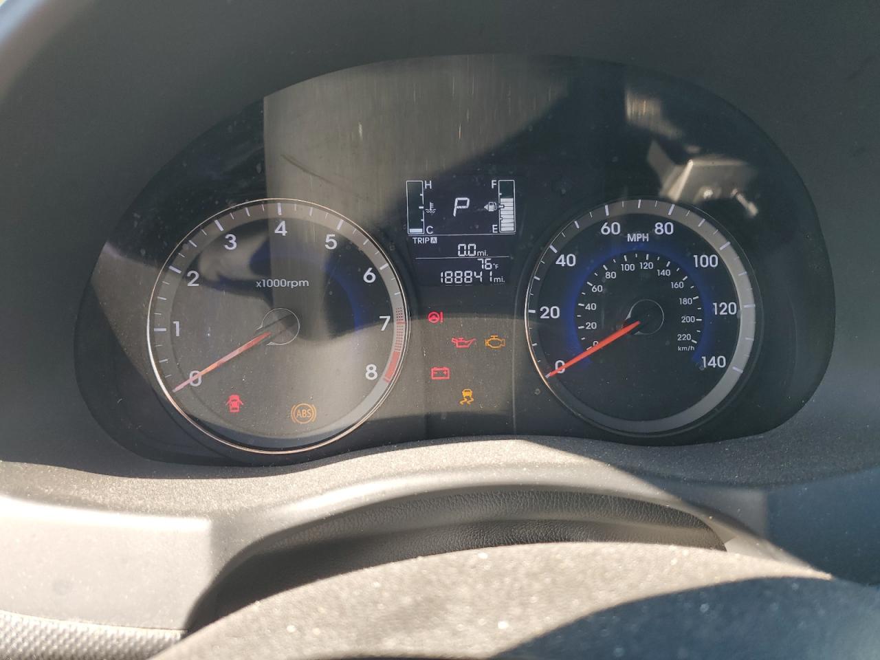 2017 Hyundai Accent Se VIN: KMHCT5AE5HU336836 Lot: 86067825