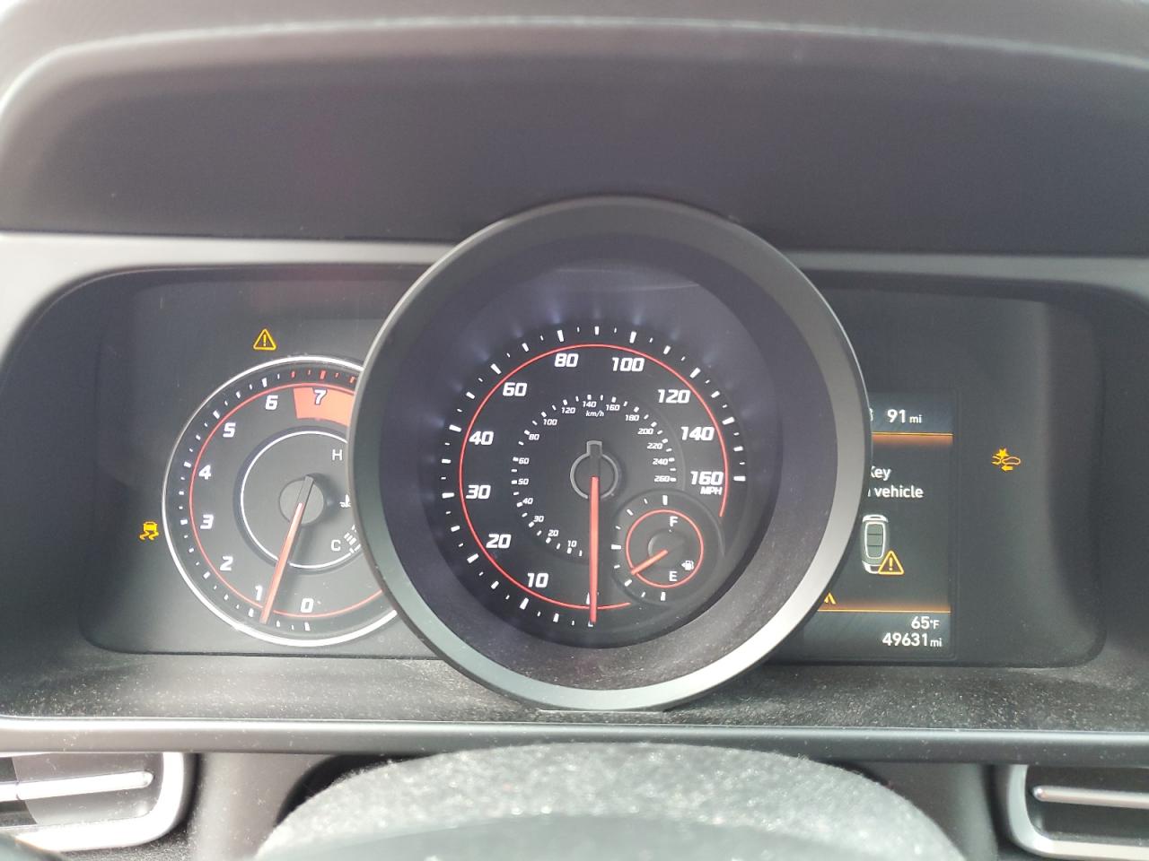 2021 Hyundai Elantra Sel VIN: 5NPLM4AG2MH000840 Lot: 86447155