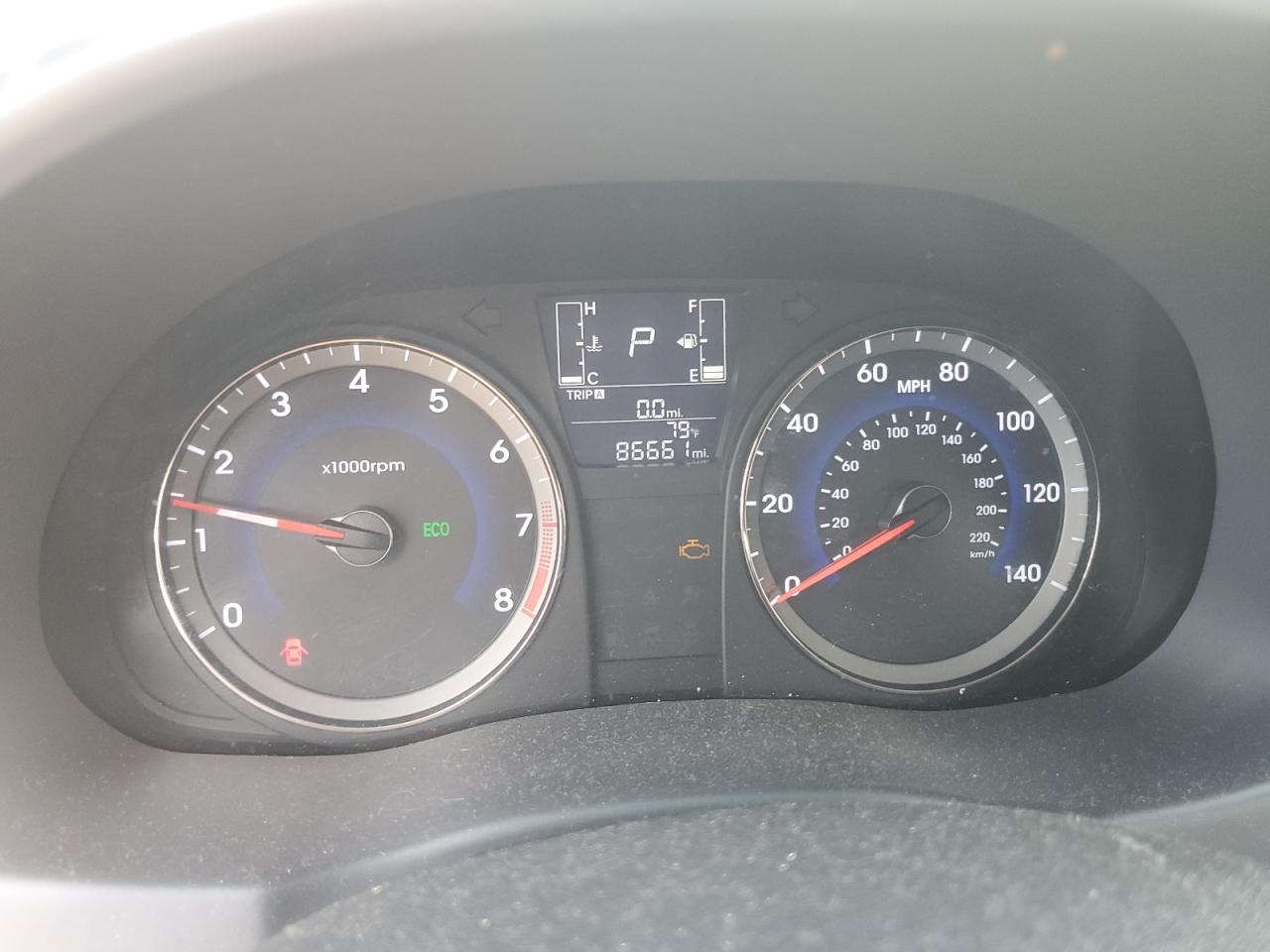 2017 Hyundai Accent Se VIN: KMHCT4AE5HU199794 Lot: 81652135