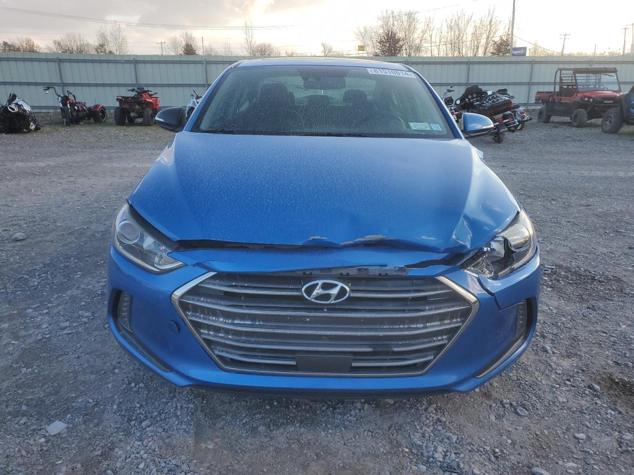 2017 Hyundai Elantra - Image 5