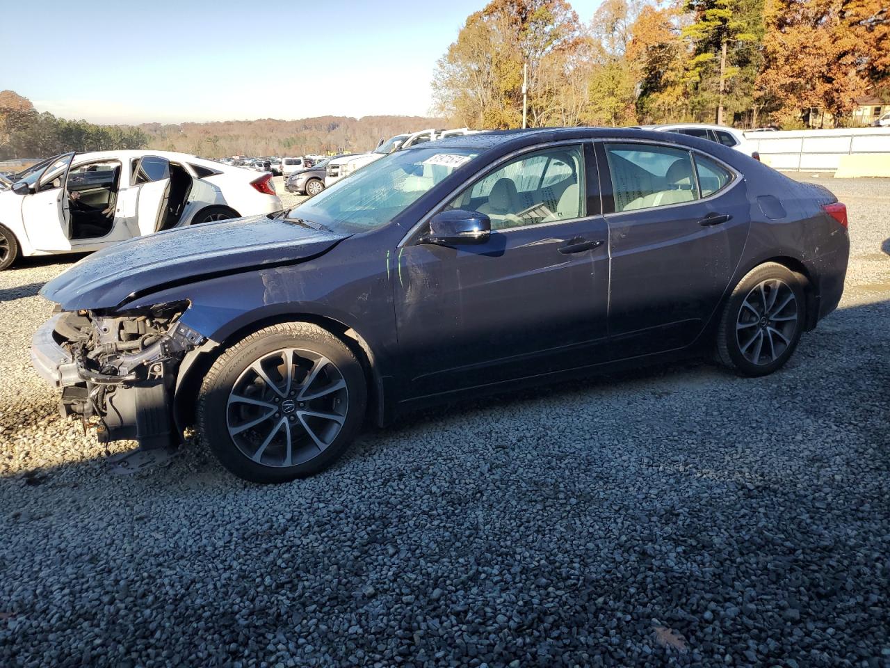 2017 Acura TLX - Image 1
