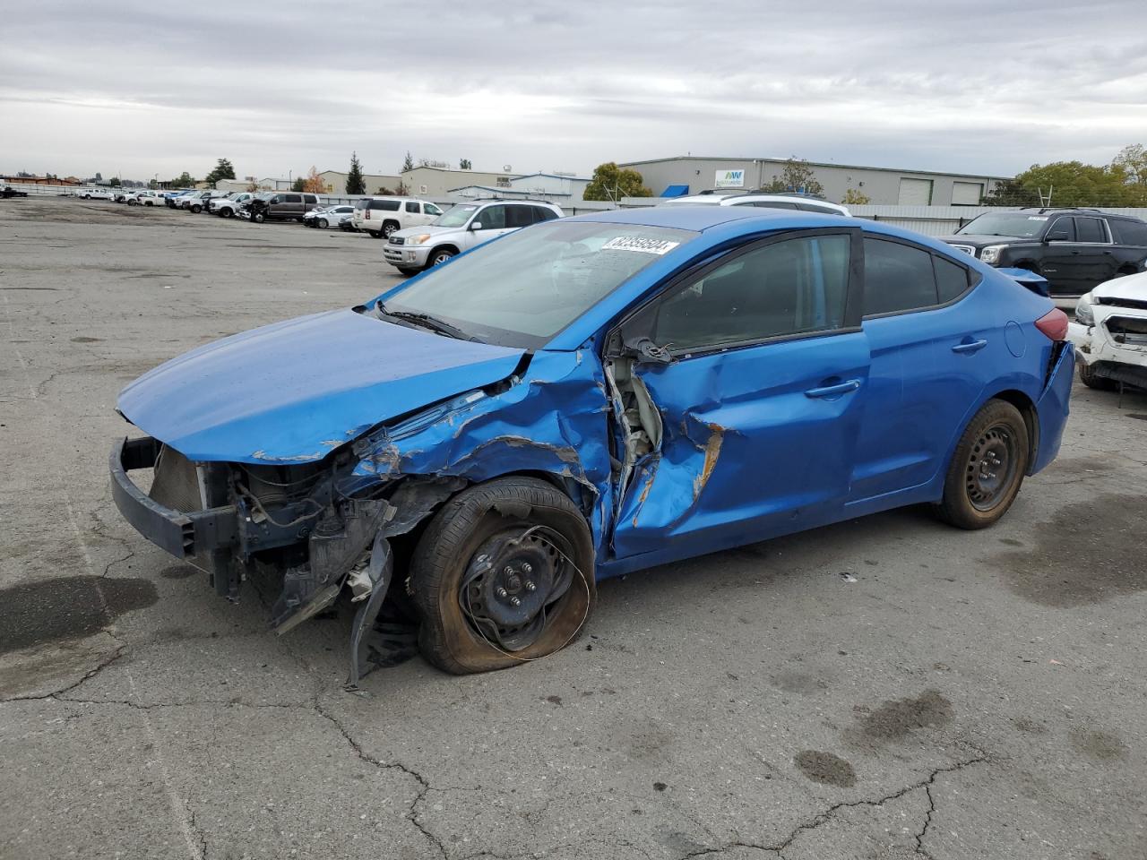 2017 Hyundai Elantra - Image 1