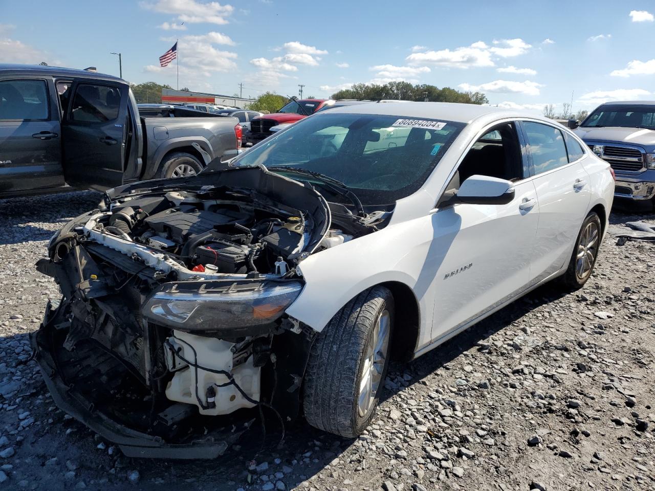 2018 Chevrolet Malibu - Image 1