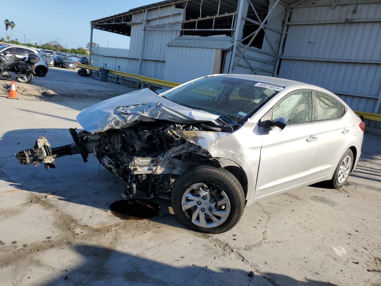 2017 Hyundai Elantra - Image 1