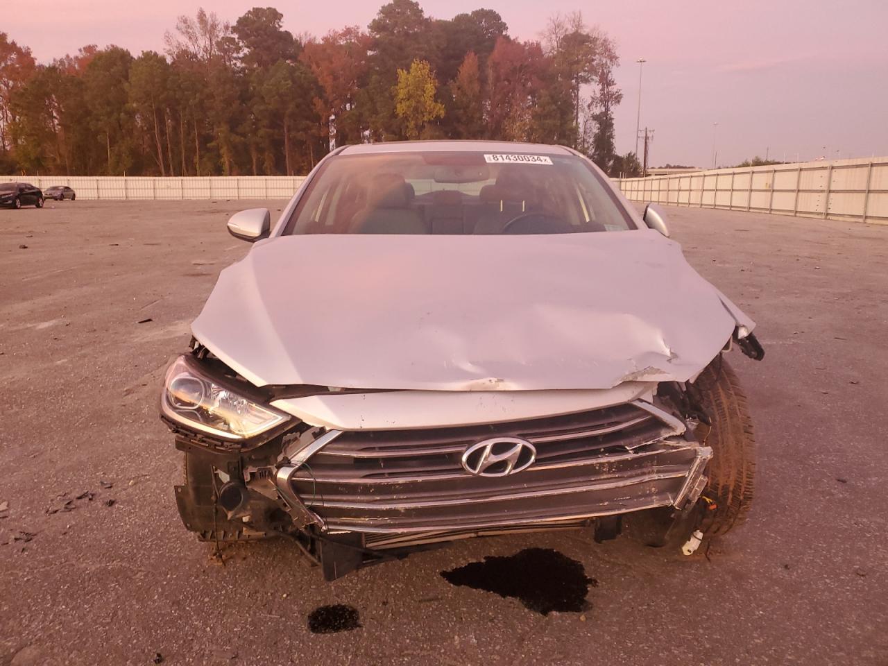 2017 Hyundai Elantra - Image 5