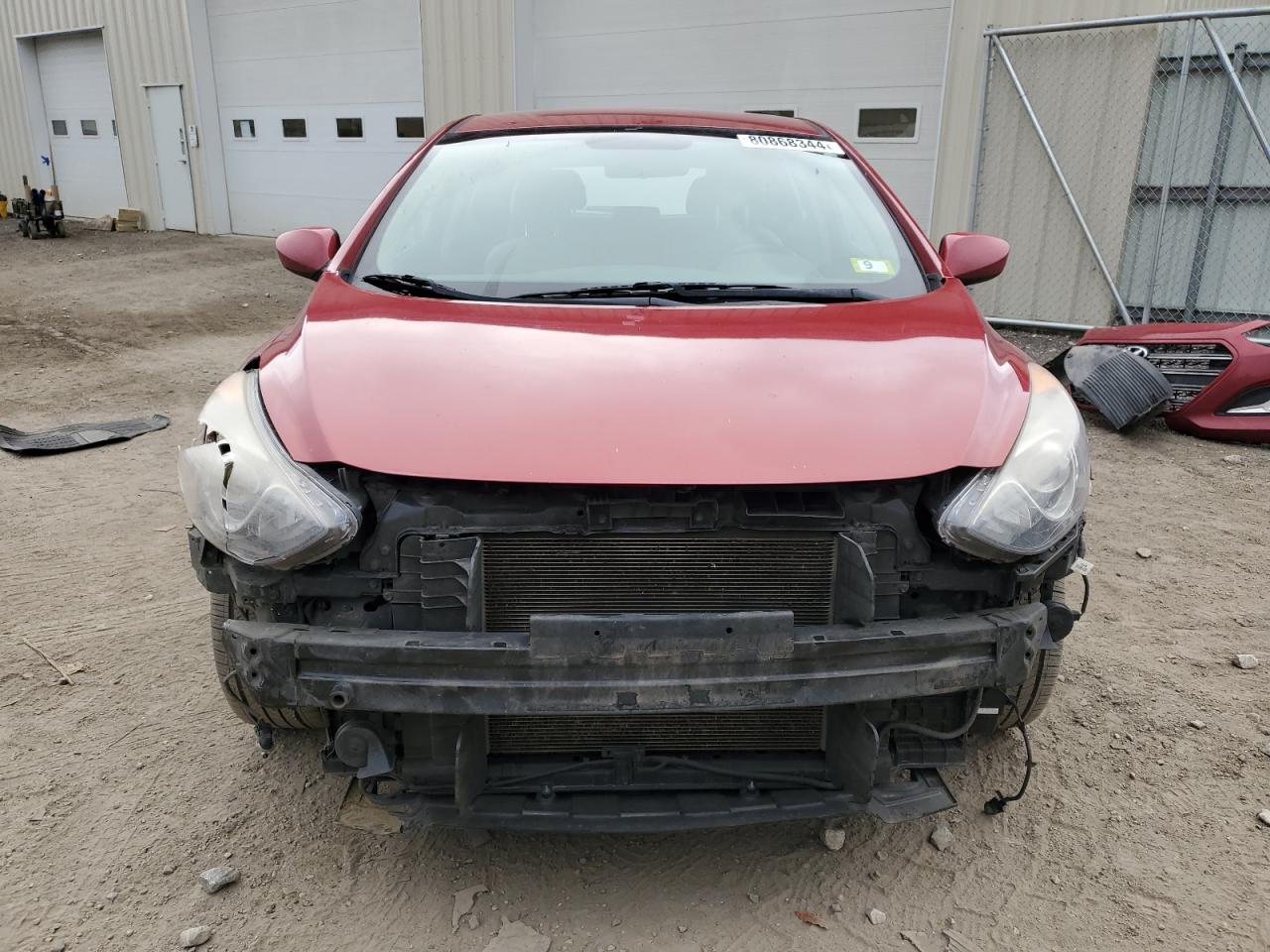 2017 Hyundai Elantra - Image 5