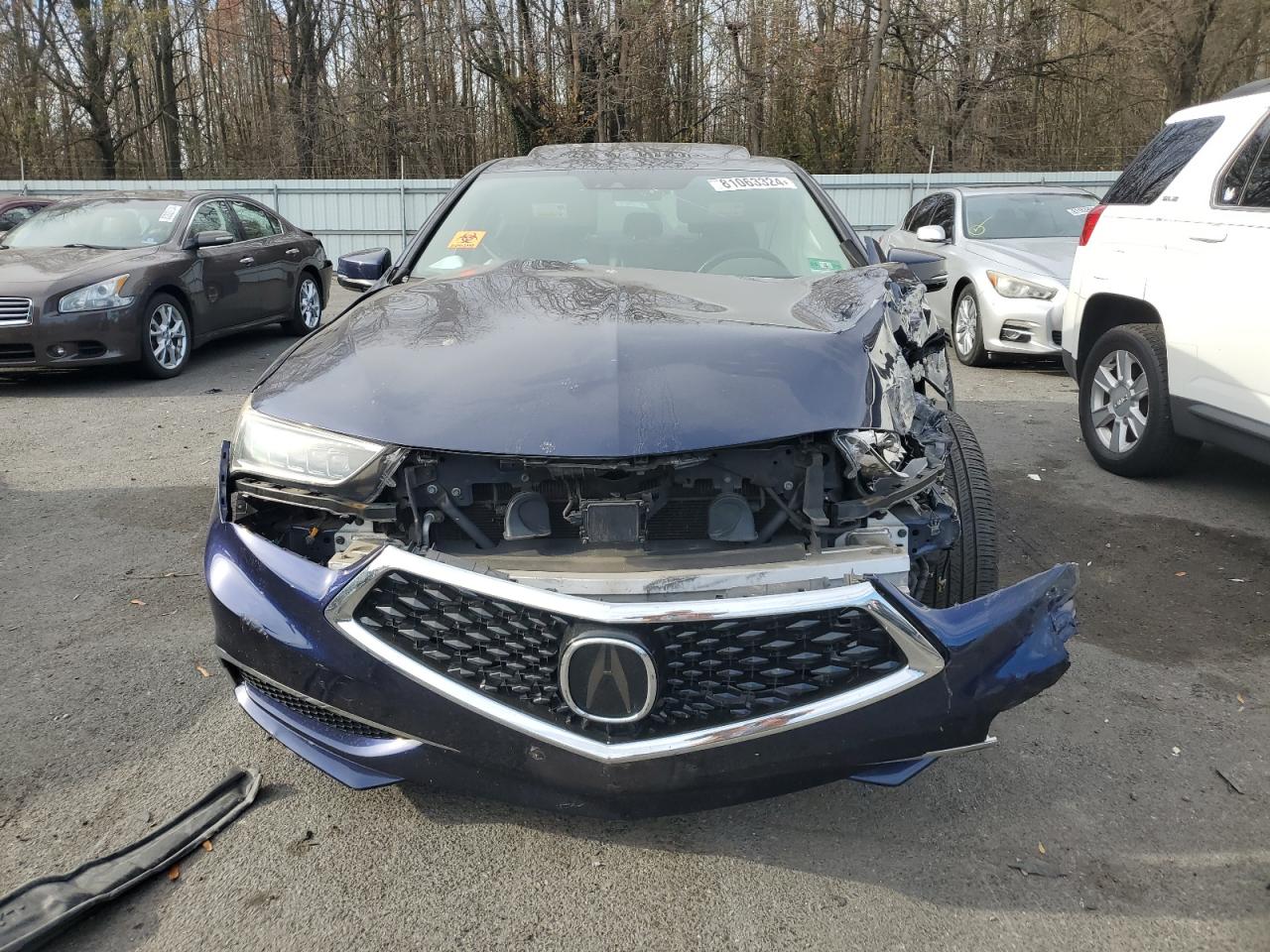 2018 Acura TLX - Image 5