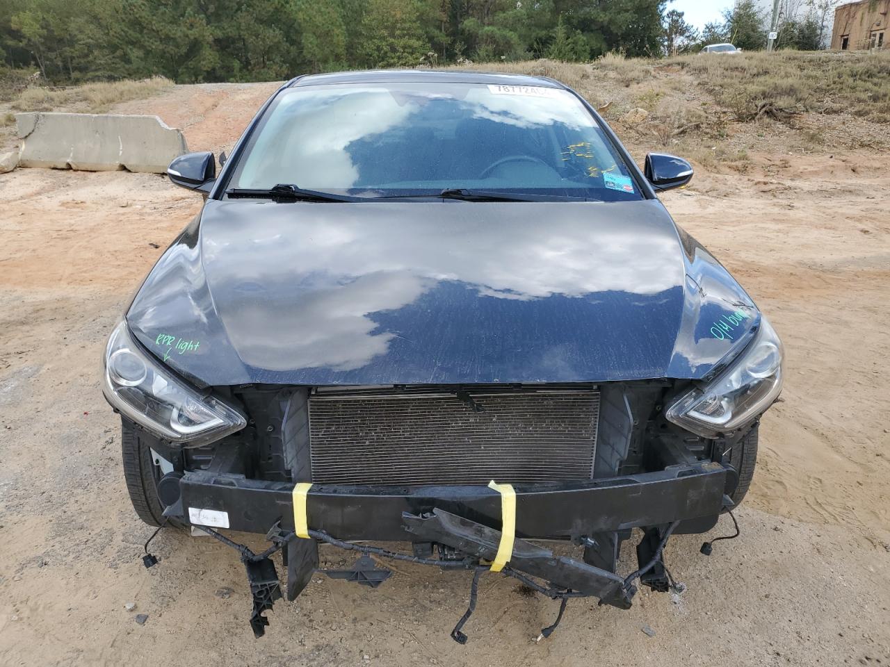 2017 Hyundai Elantra - Image 5