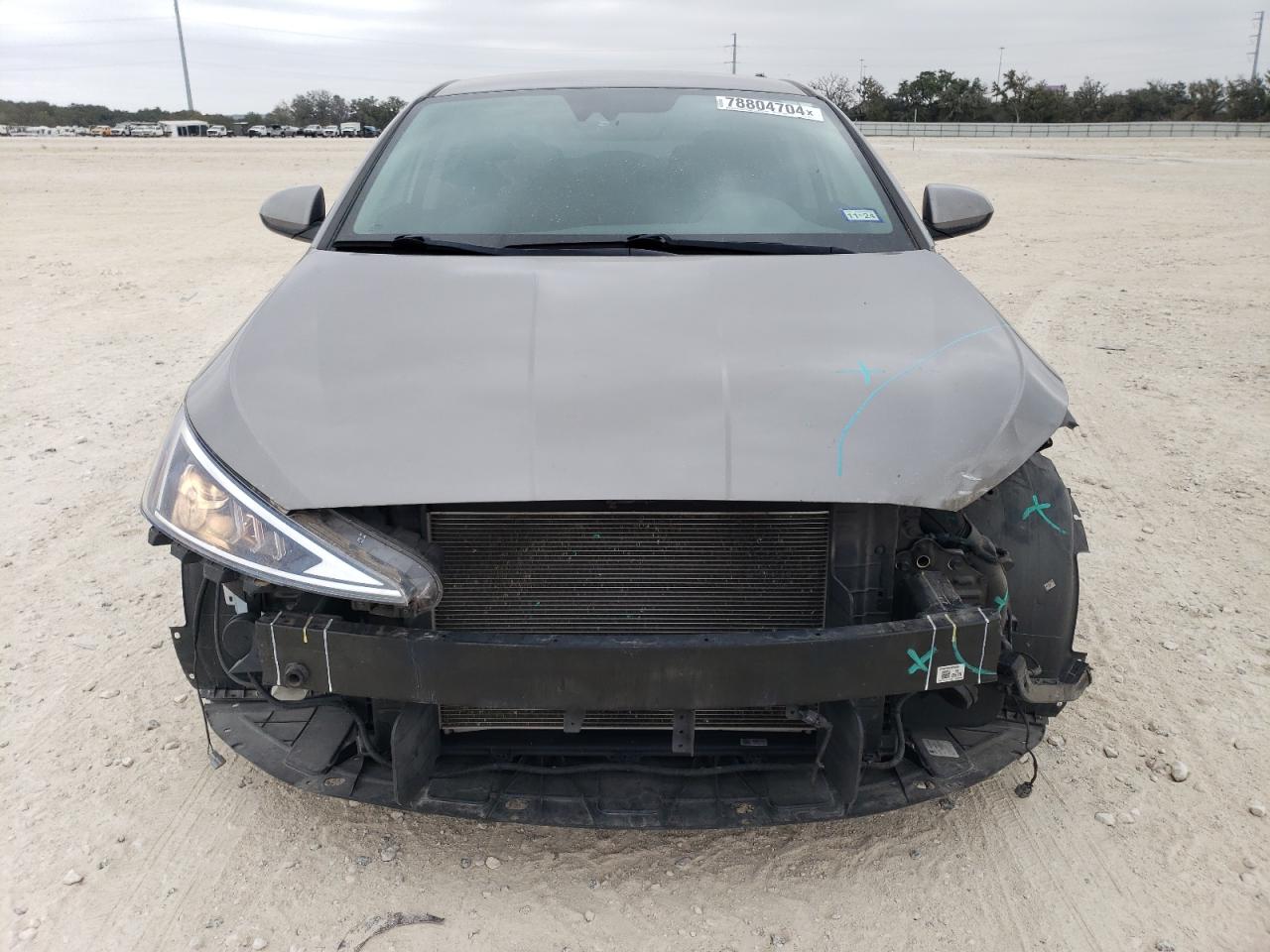 2020 Hyundai Elantra - Image 5