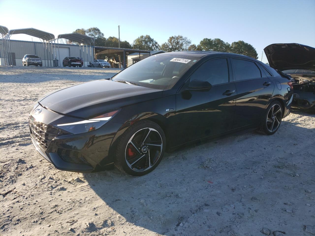 2023 Hyundai Elantra - Image 1