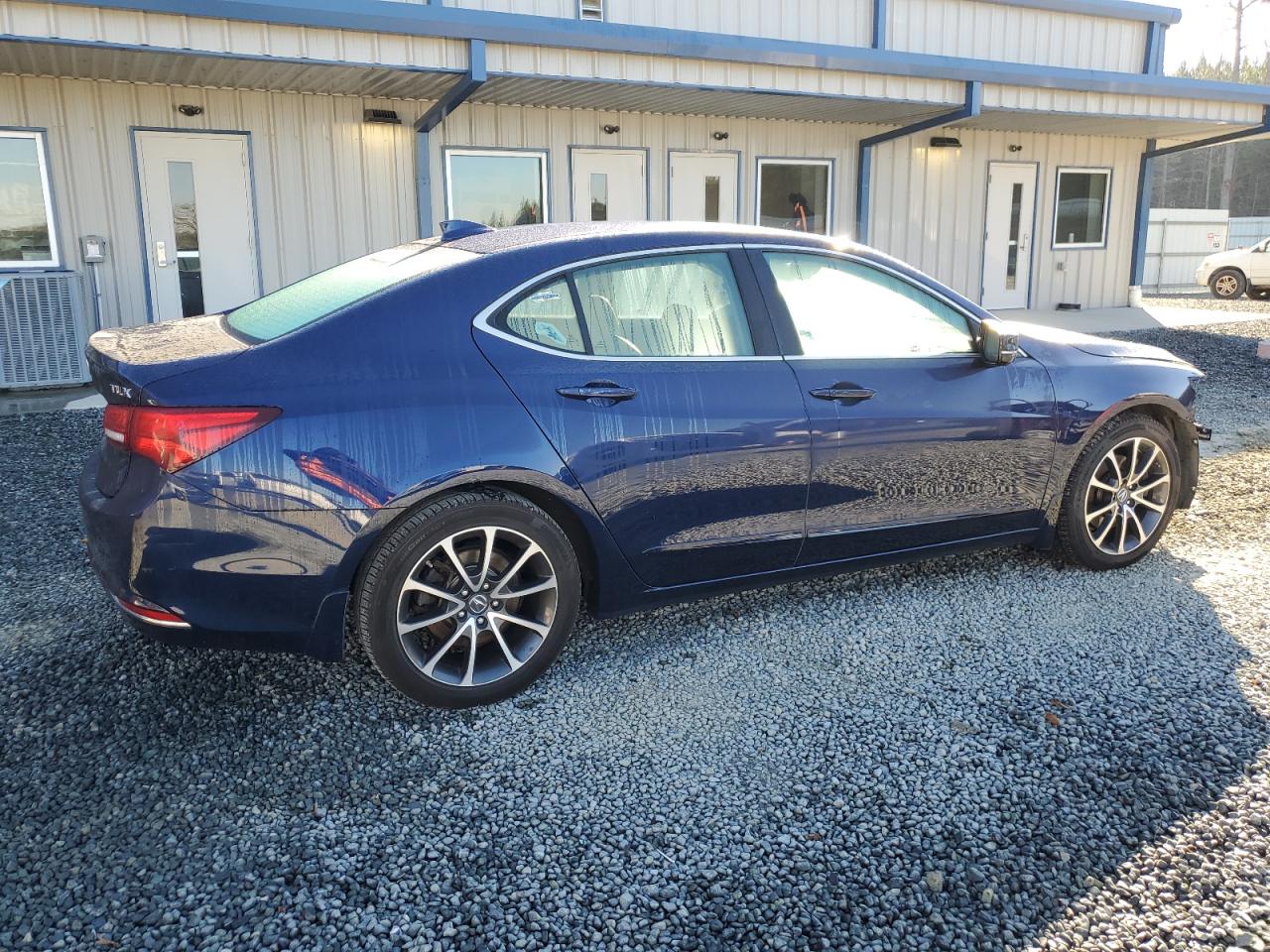 2017 Acura TLX - Image 3
