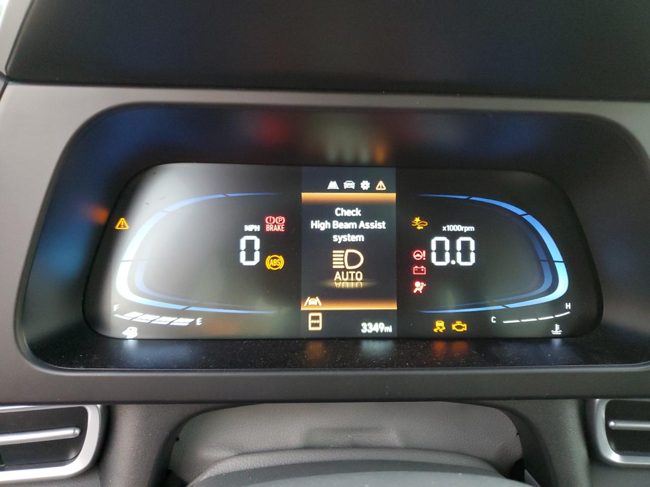 2024 Hyundai Elantra - Image 9