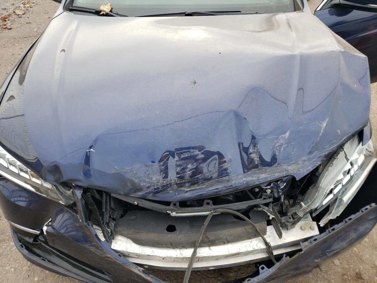 2017 Acura TLX - Image 11