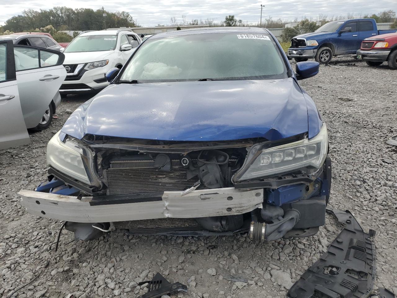 2017 Acura ILX - Image 5