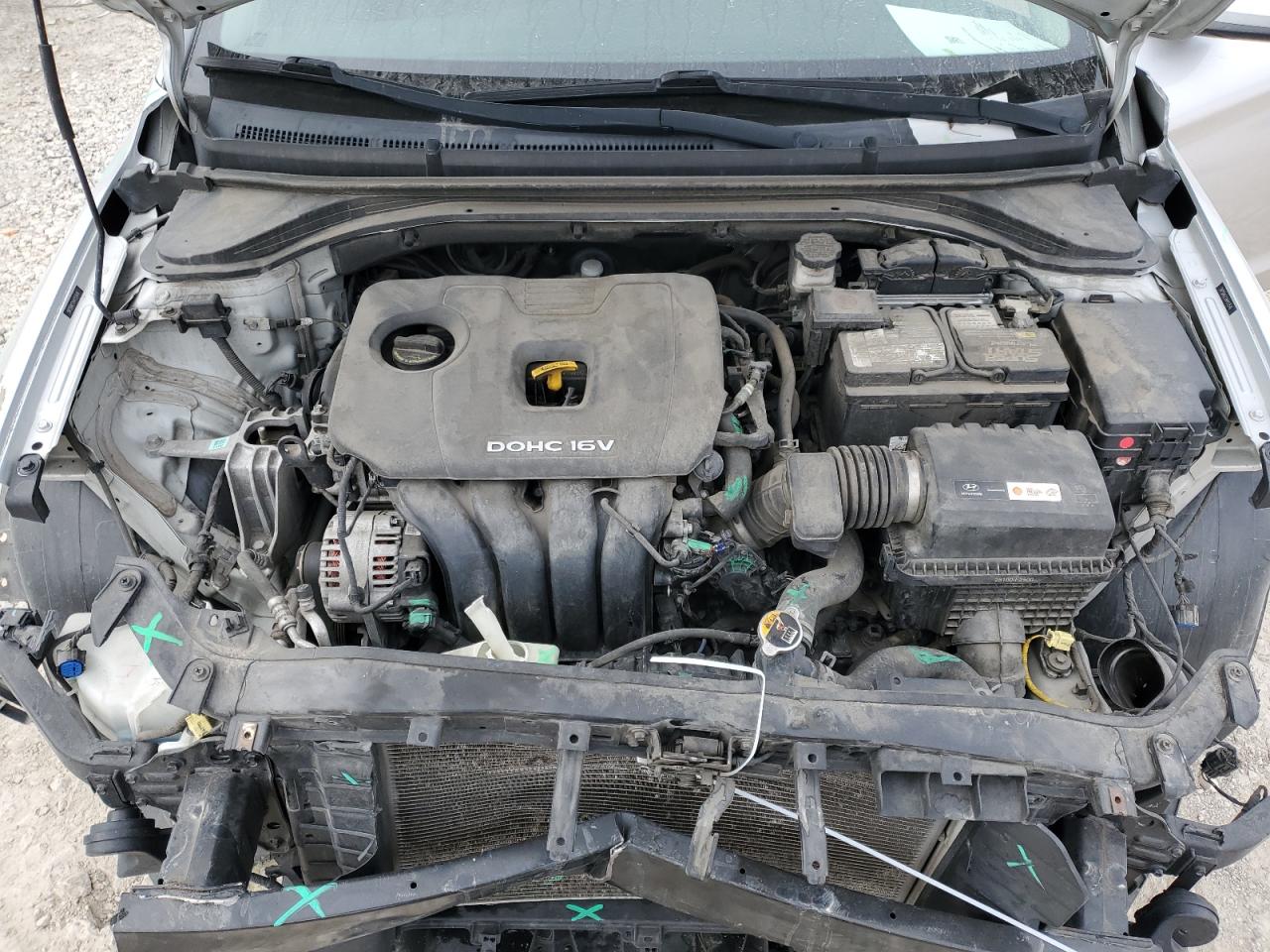 2017 Hyundai Elantra - Image 11