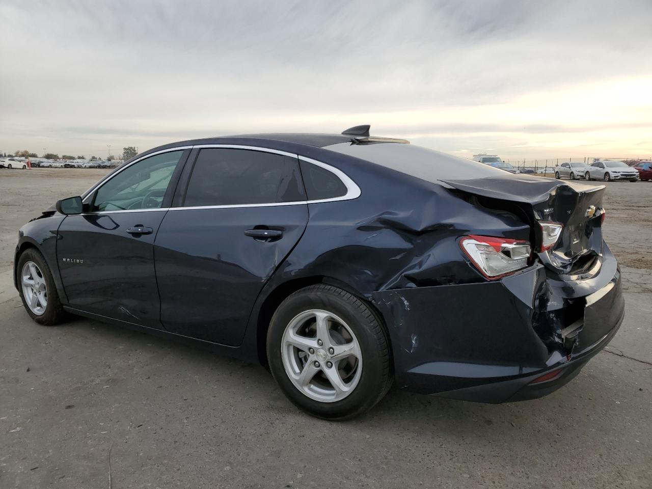 2017 Chevrolet Malibu - Image 2