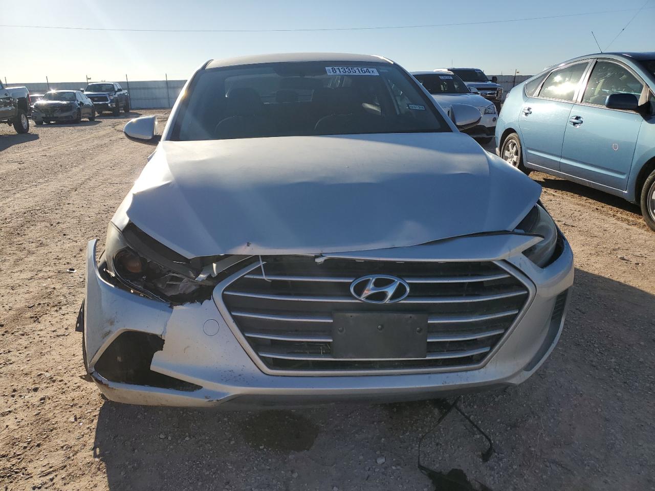 2017 Hyundai Elantra - Image 5