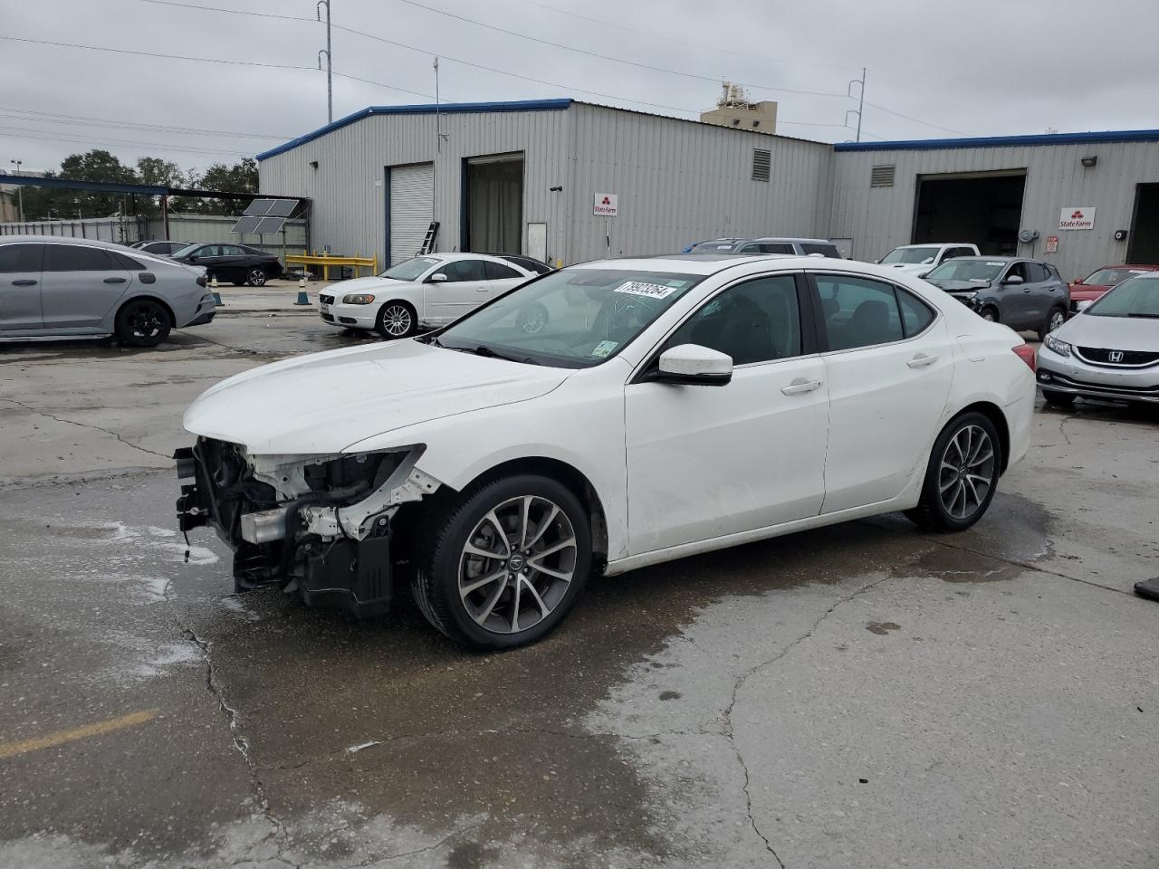 2015 Acura TLX - Image 1