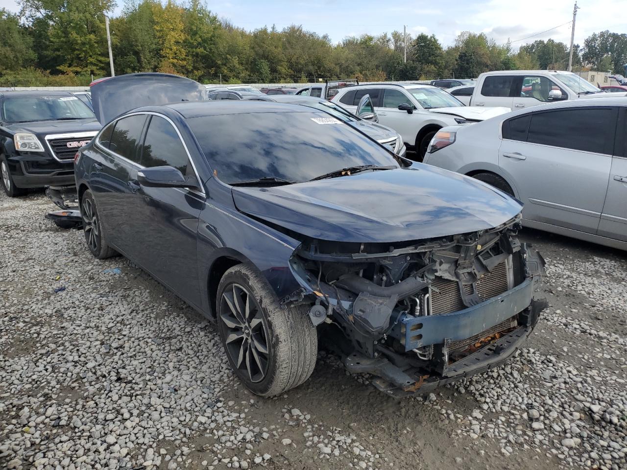 2017 Chevrolet Malibu - Image 4