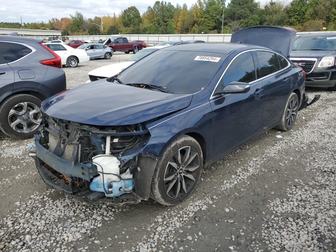 2017 Chevrolet Malibu - Image 1