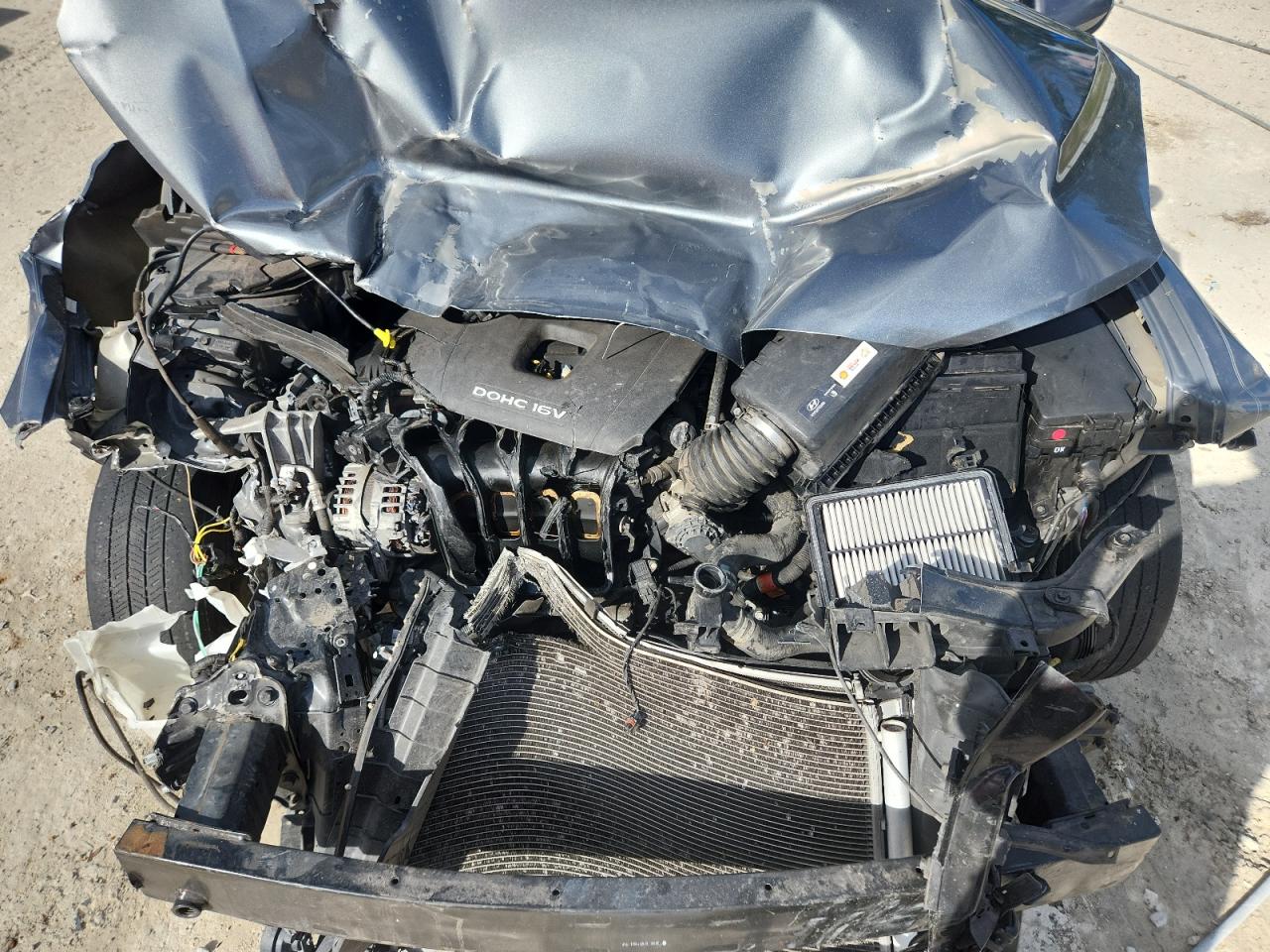 2017 Hyundai Elantra Se VIN: KMHD74LF0HU152297 Lot: 92057135