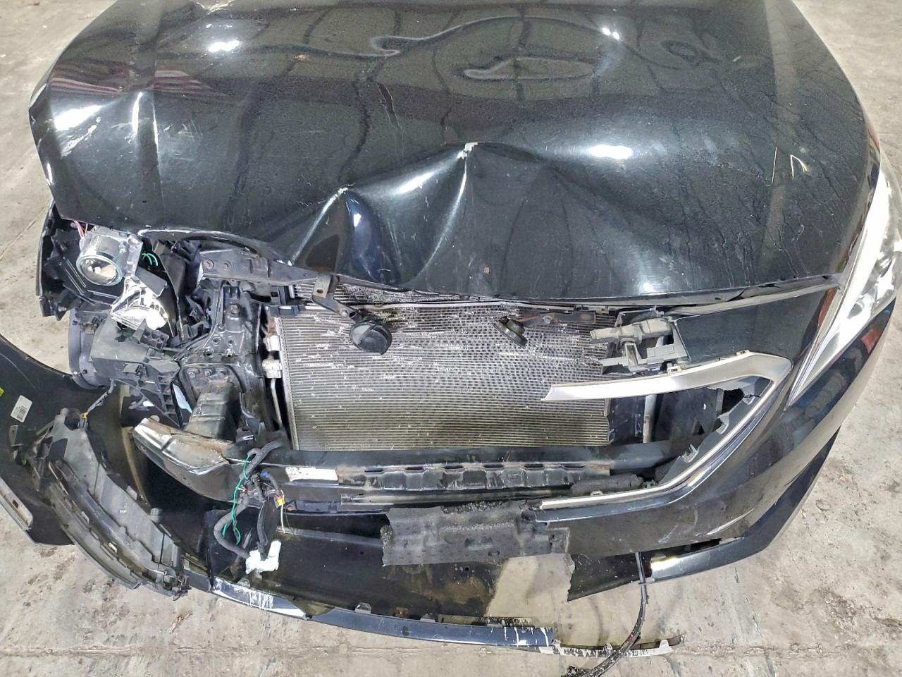 2015 Hyundai Sonata Se VIN: 5NPE24AF9FH158584 Lot: 94139195