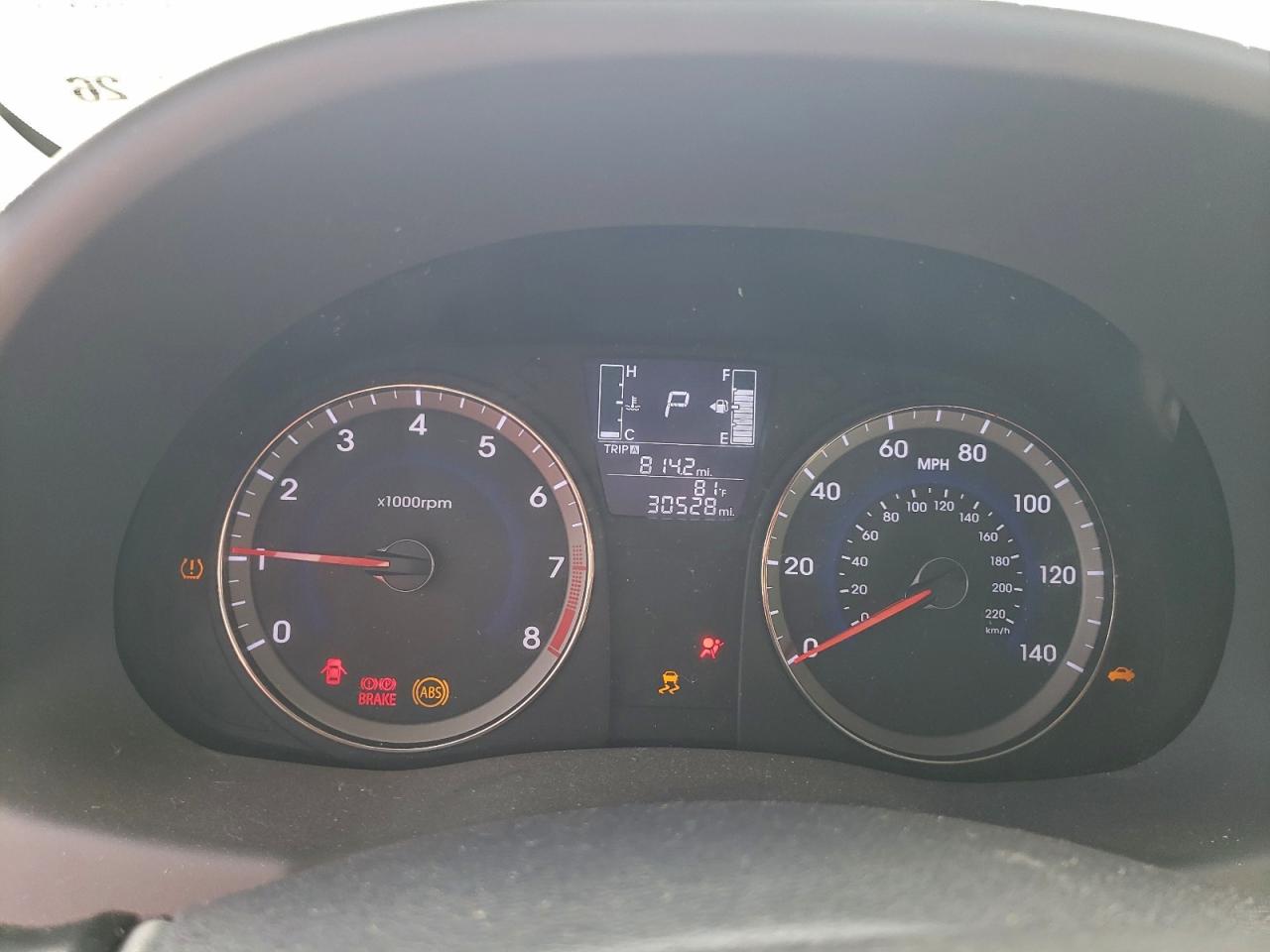 2016 Hyundai Accent Se VIN: KMHCT4AE7GU074651 Lot: 93931895