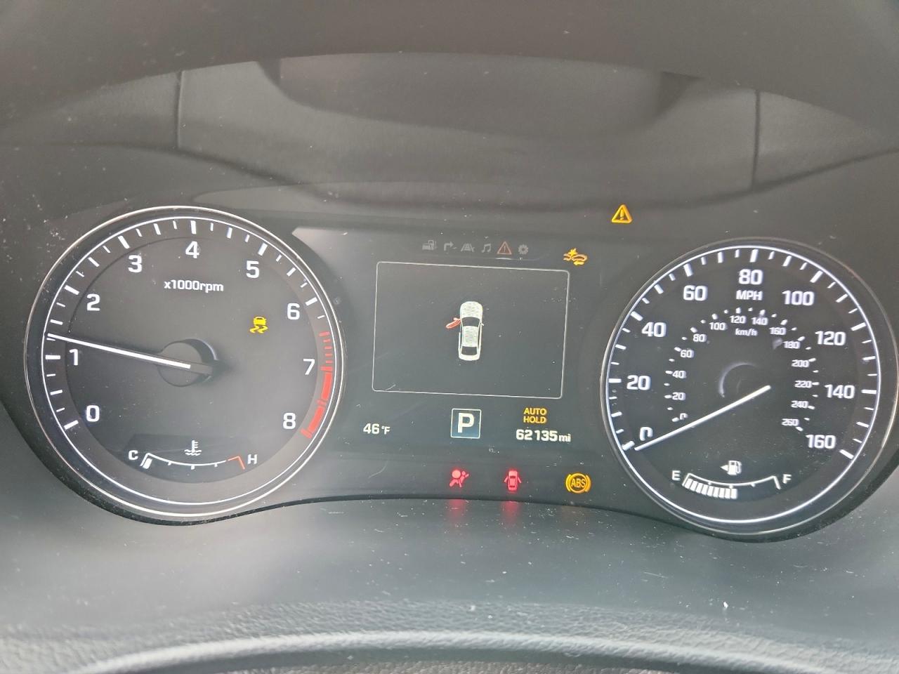 2017 Genesis G80 Base VIN: KMHGN4JE6HU171711 Lot: 93887985