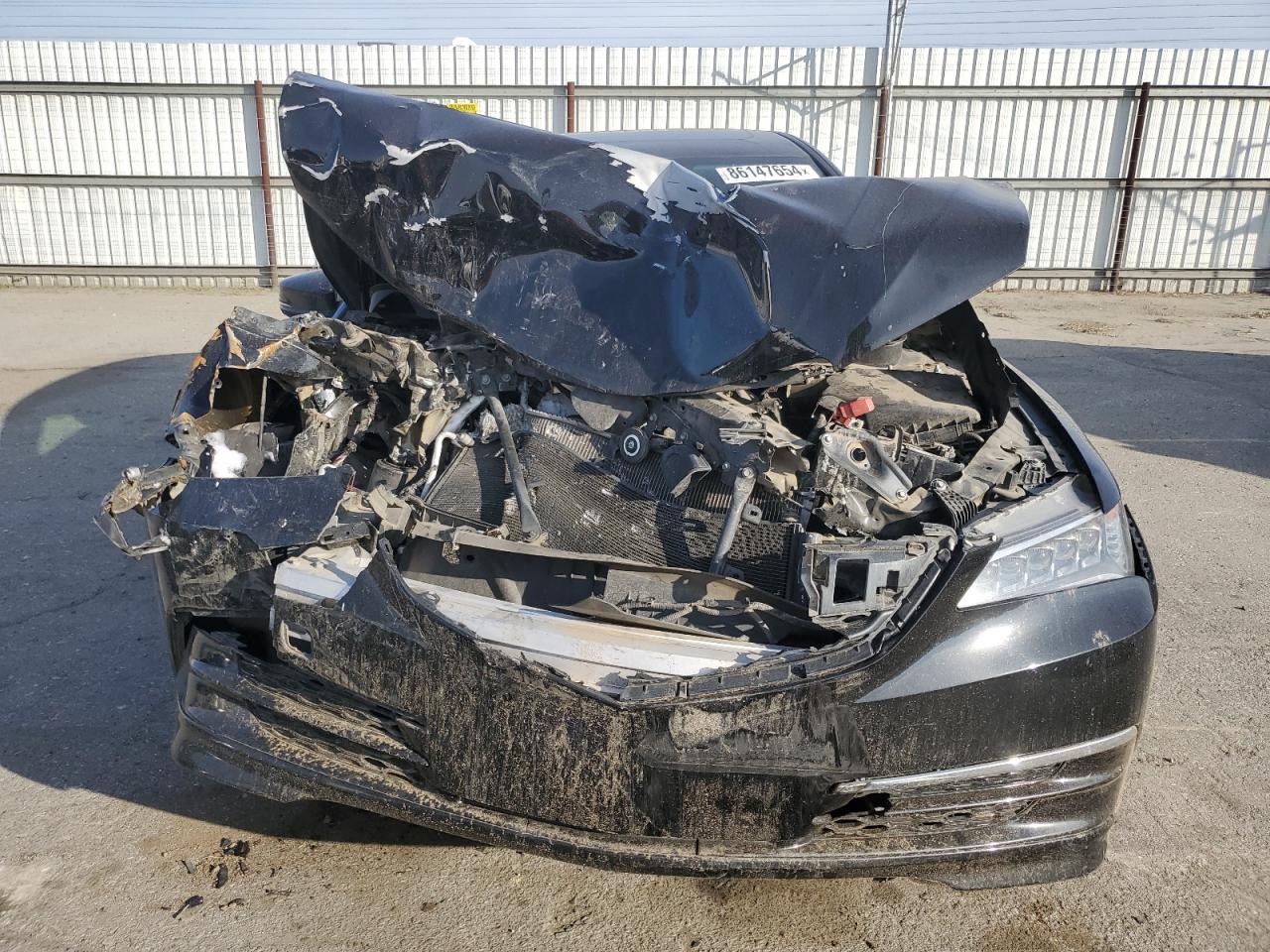 VIN 19UUB1F58HA000971 2017 ACURA TLX no.5