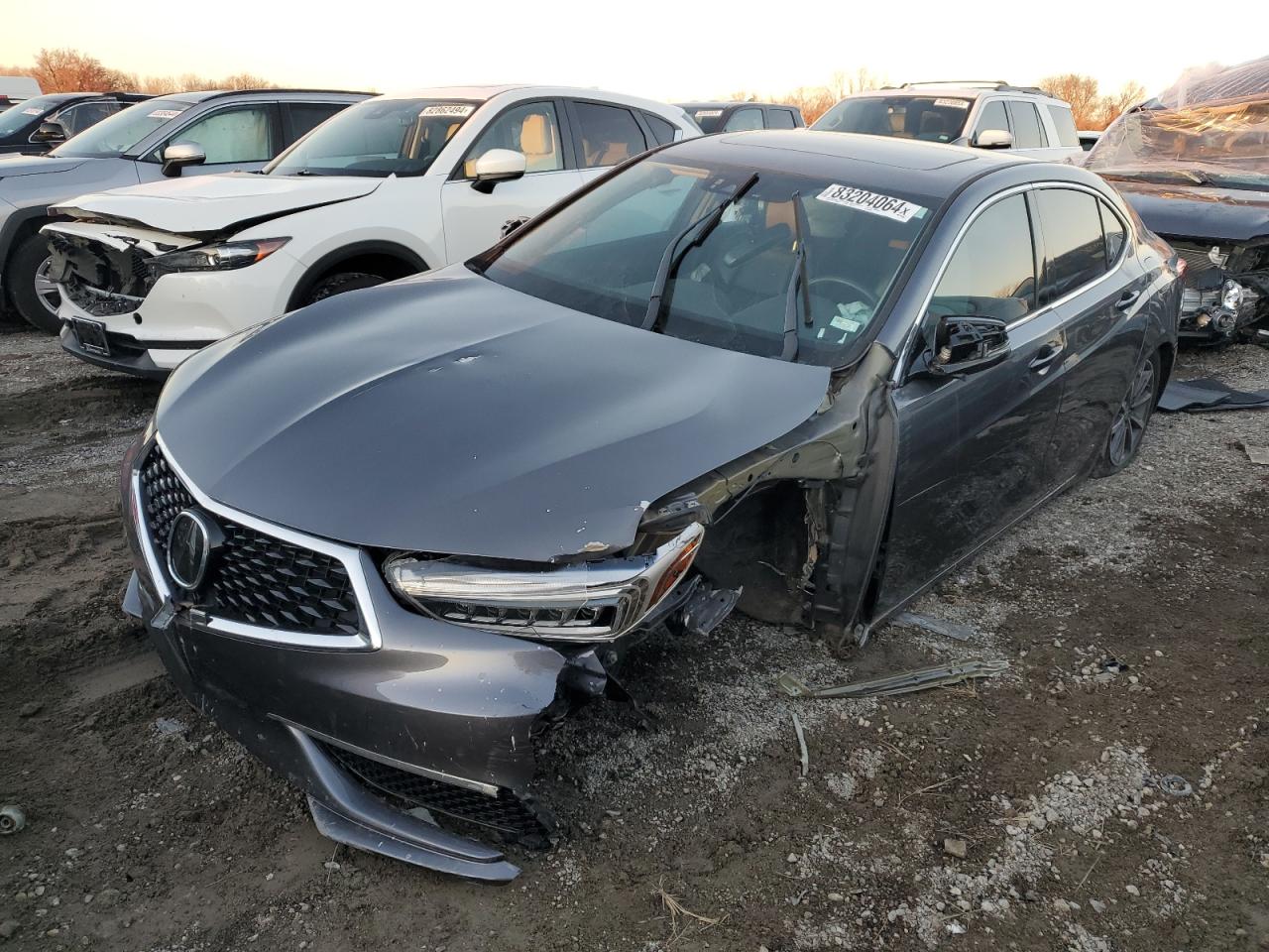 2018 Acura TLX - Image 1