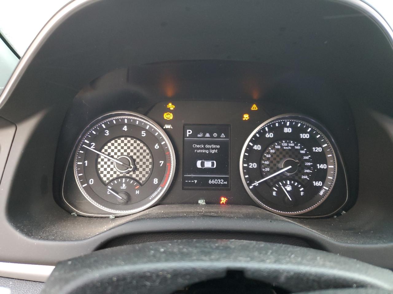 2020 Hyundai Elantra - Image 9