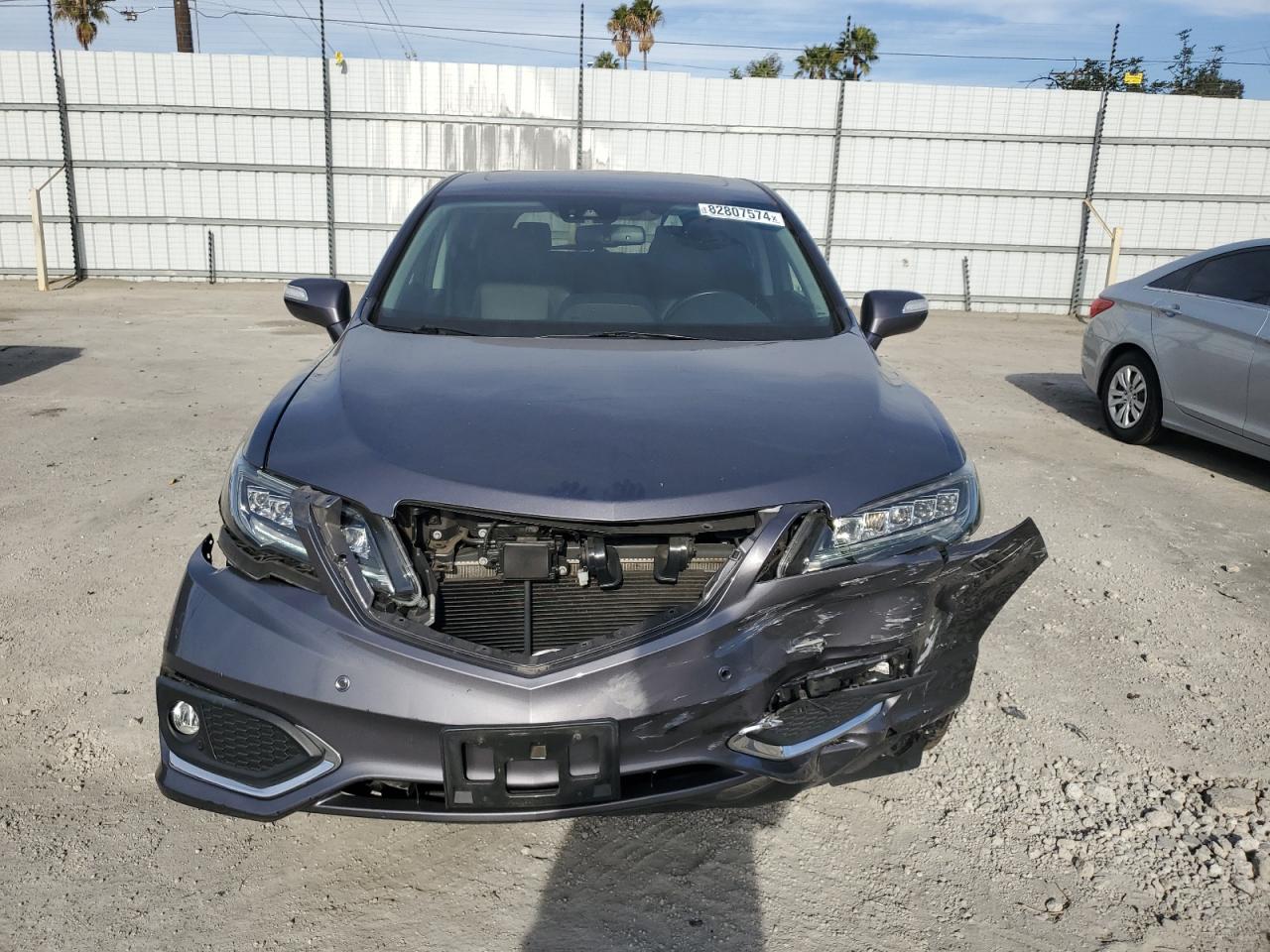 2017 Acura RDX - Image 5