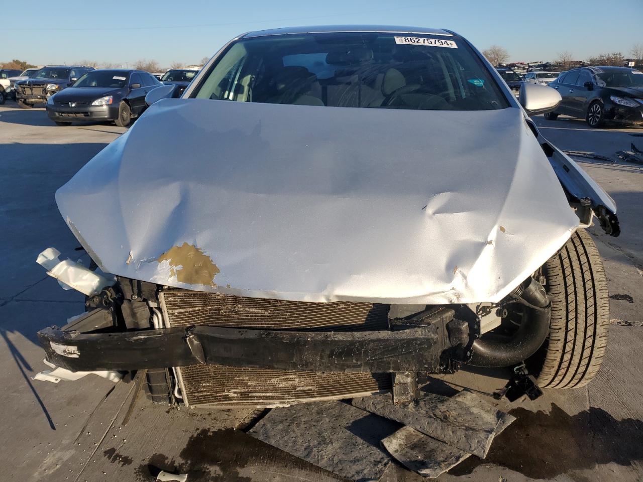 2017 Hyundai Elantra - Image 5