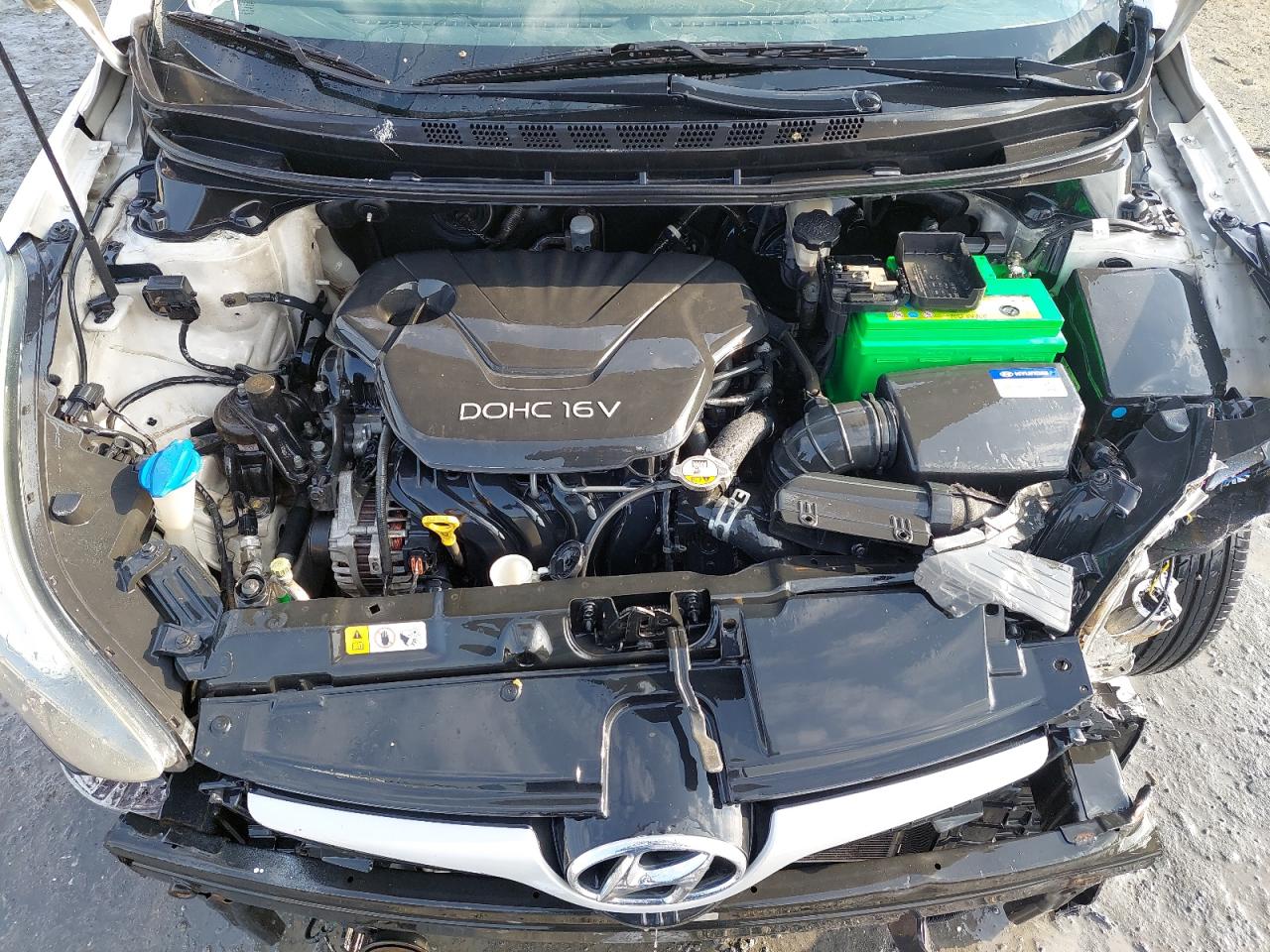KMHDG41C6FU311474 - 2015 Hyundai Elantra Se - #83925314